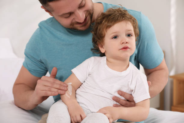 istock Father applying ointment onto his son`s arm on bed at home 1713863087
