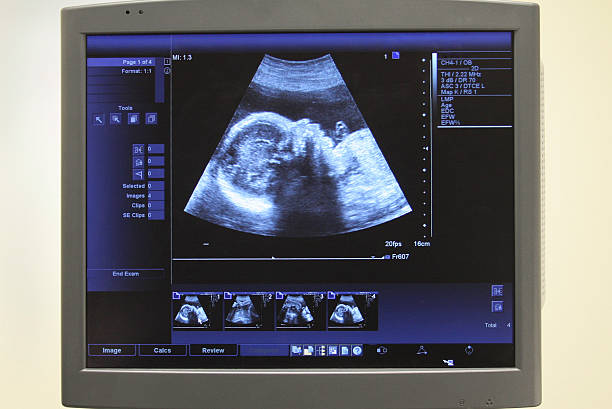 Ultrasound monitor with fetus image stock photo