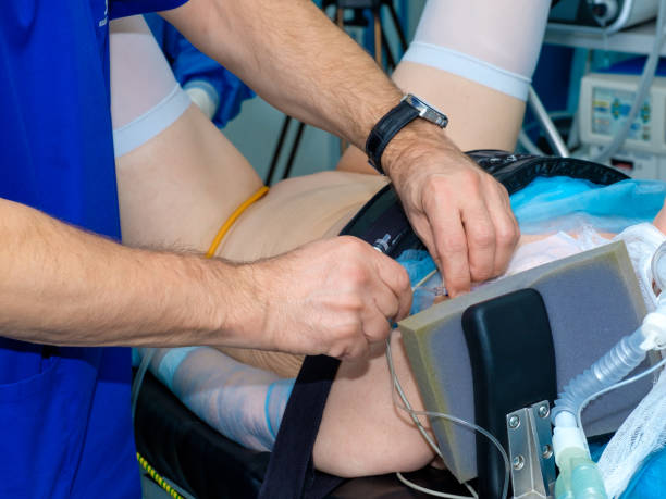 istock Doctor's hands install a catheter for anesthesia 1714552660