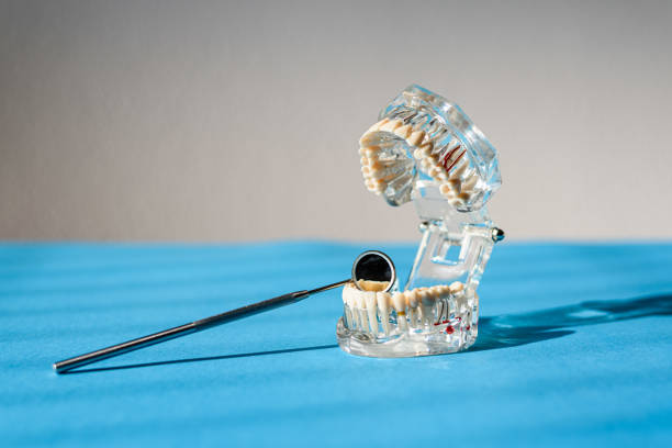 istock Plastic model of a jaw with complete teeth for study, isolated on background with copy space. 1714684535