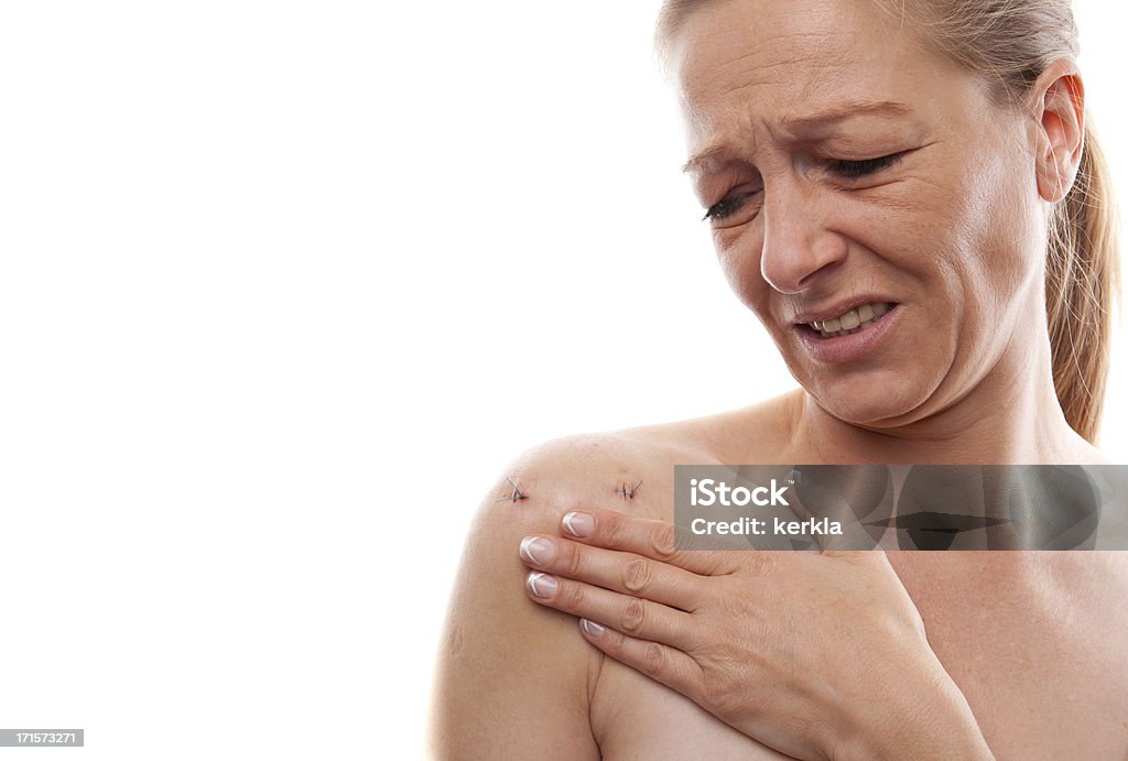 Woman with pain after shoulder operation Shoulder Stock Photo