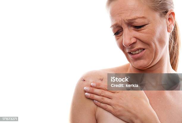 Woman With Pain After Shoulder Operation Stock Photo - Download Image Now - Shoulder, Surgery, Scarification