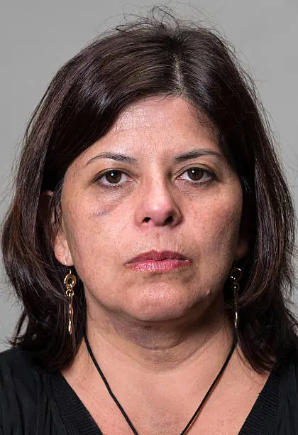 Mug shot of an Abused Hispanic Woman on gray background