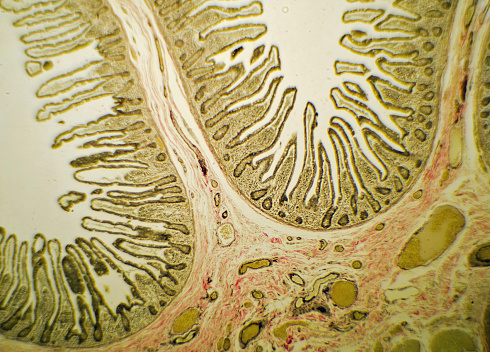 A microscope slide showing a stained section of a human bowel, or small intestine.  It was taken through microscope lens that has a central focus through a thin layer of glass.