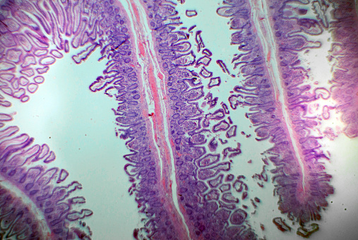 A microscope slide showing a stained section of a human bowel, or small intestine.  It was taken through microscope lens that has a central focus through a thin layer of glass.