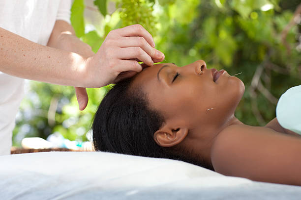 Acupuncture Chinese alternative medicine. Needles being inserted into a patient's face skin. relieves stock pictures, royalty-free photos & images