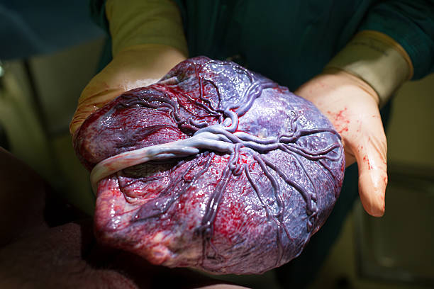 Doctor showing placenta just after childbirth stock photo