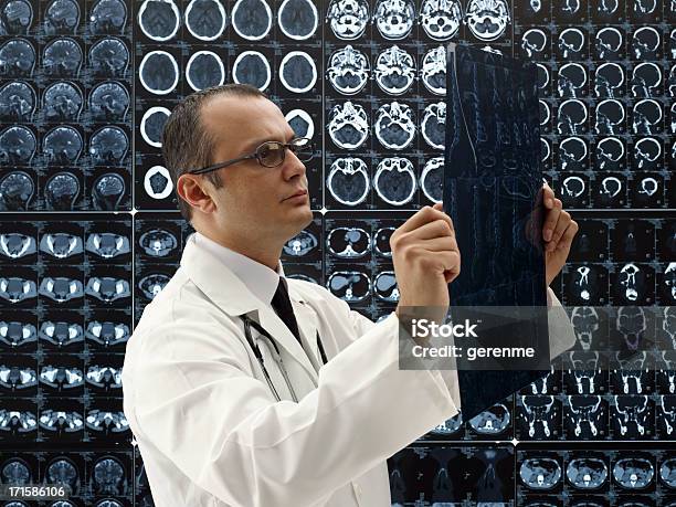 담담의 루킹 X선 MRI 스캔에 대한 스톡 사진 및 기타 이미지 - MRI 스캔, X-레이, 걱정하는