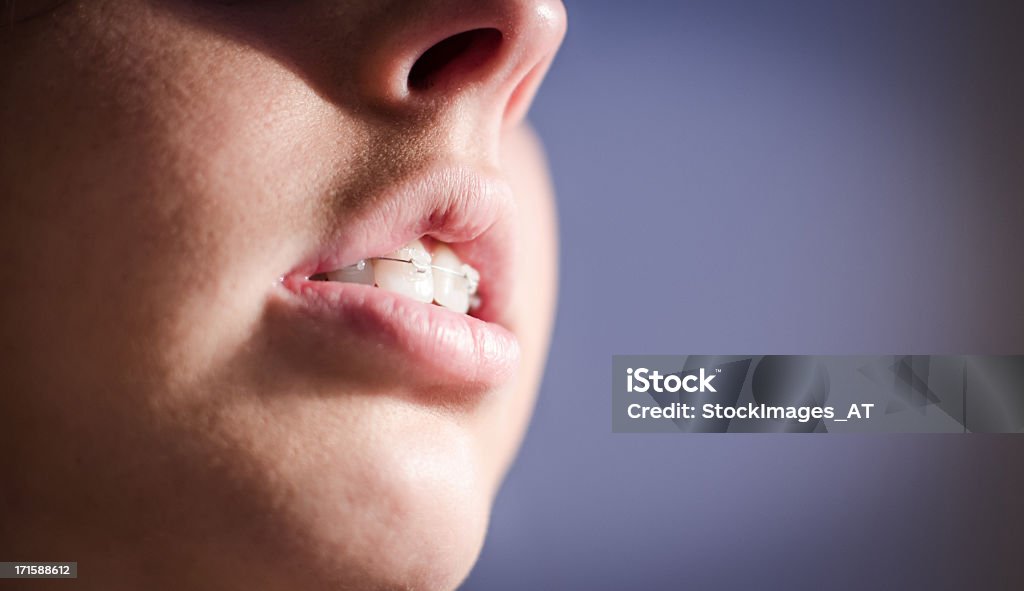 Adulto joven mujer con abrazadera de dental - Foto de stock de Gordo - Complexión libre de derechos