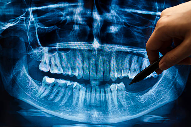 歯科 x 線 - 歯 写真 ストックフォトと画像