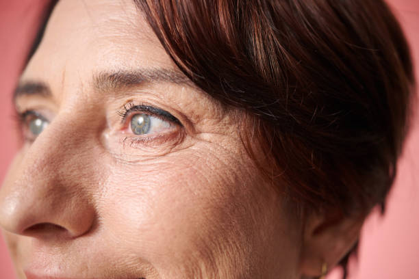 istock Mature Woman with Eye Wrinkles 1716771283