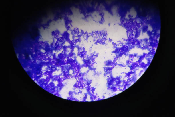 gram-negative bacterial cells under the microscope - microscope view imagens e fotografias de stock