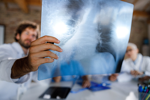 Close up of medical experts analyzing lung scan on a meeting in hospital.