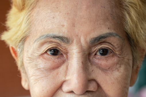 Close-up of elderly woman's eye, reflecting a lifetime of experience and wisdom. The deep expressions in her sensitive eyes tell stories of both joy and sadness, revealing the wrinkle beauty of age.