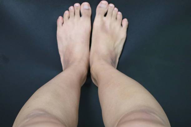 istock Legs after removing unwanted hair 1718818328