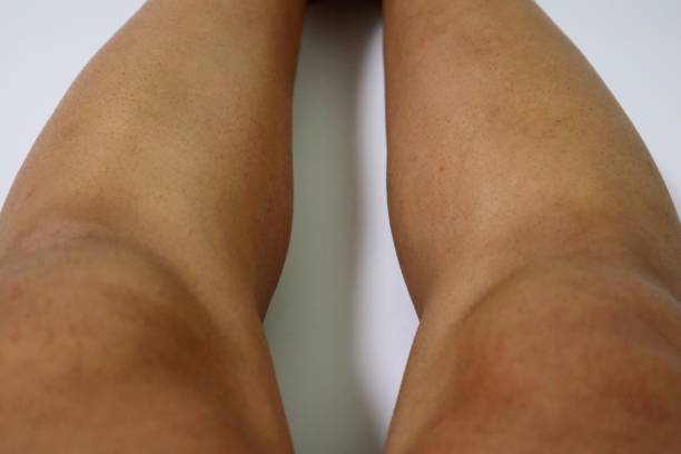 Barefoot runner on a Marathon