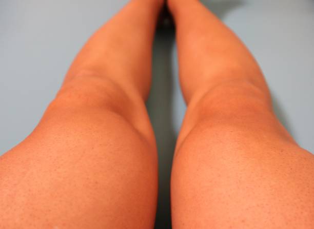 istock Legs after removing unwanted hair 1718825071