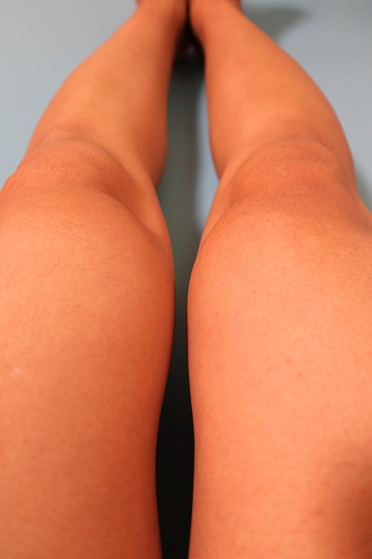 Close-up of legs after removing unwanted hair