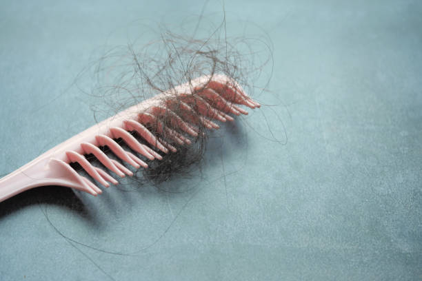 istock a brush with lost hair on table 1719095161