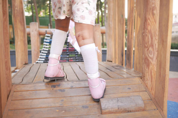 Child cerebral palsy disability, legs orthosis