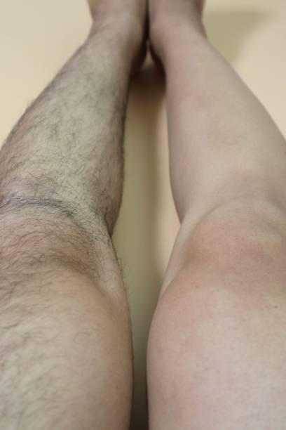 istock Legs before and after hair removal 1719235103