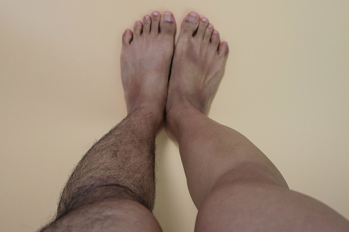 Close-up of legs before and after hair removal