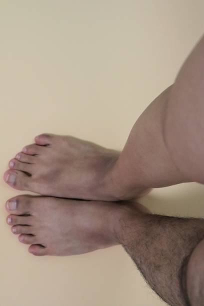 istock Legs before and after hair removal 1719239428