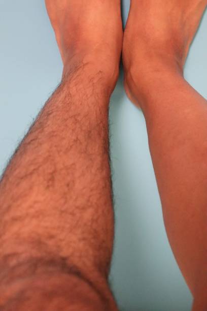 istock Legs before and after hair removal 1719245513
