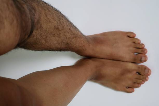 Legs before and after hair removal