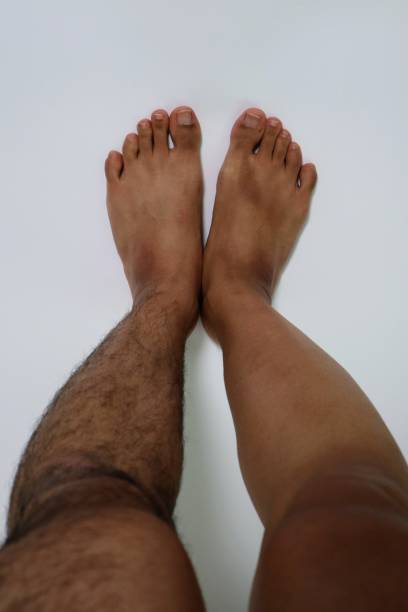 istock Legs before and after hair removal 1719249125