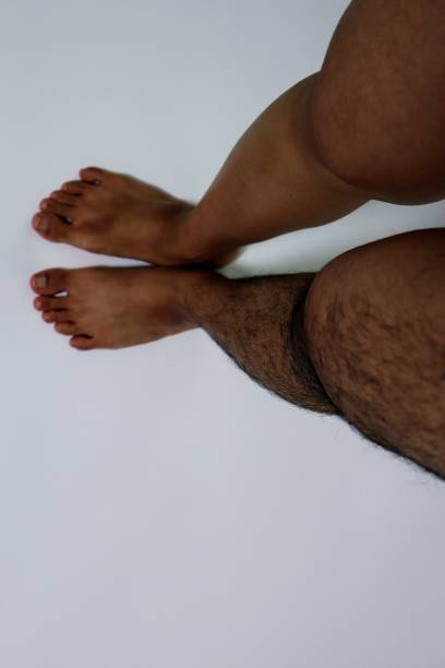 istock Legs before and after hair removal 1719249705