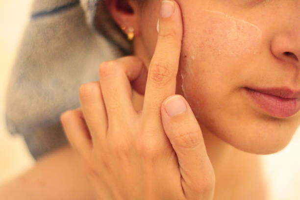 istock Young Girl Applying Cream to her Face 1719587363