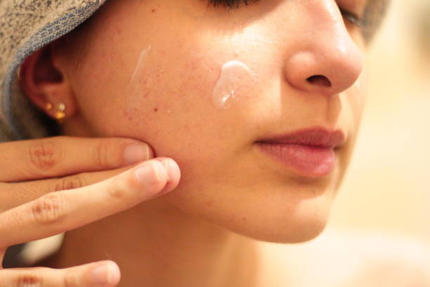 istock Young Girl Applying Cream to her Face 1719590628
