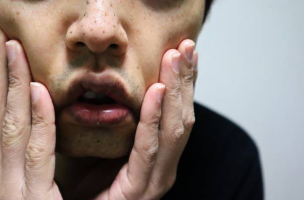istock A man suffering from dirty pores on his nose 1719860341