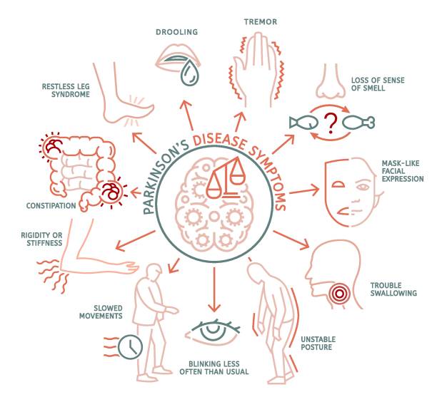 illustrations, cliparts, dessins animés et icônes de symptômes de la maladie de parkinson. infographie médicale avec icônes linéaires. - symptome