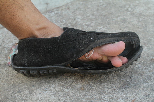 black formal shoes made of broken leather with a hole in the front so that the big toe of his left is visible