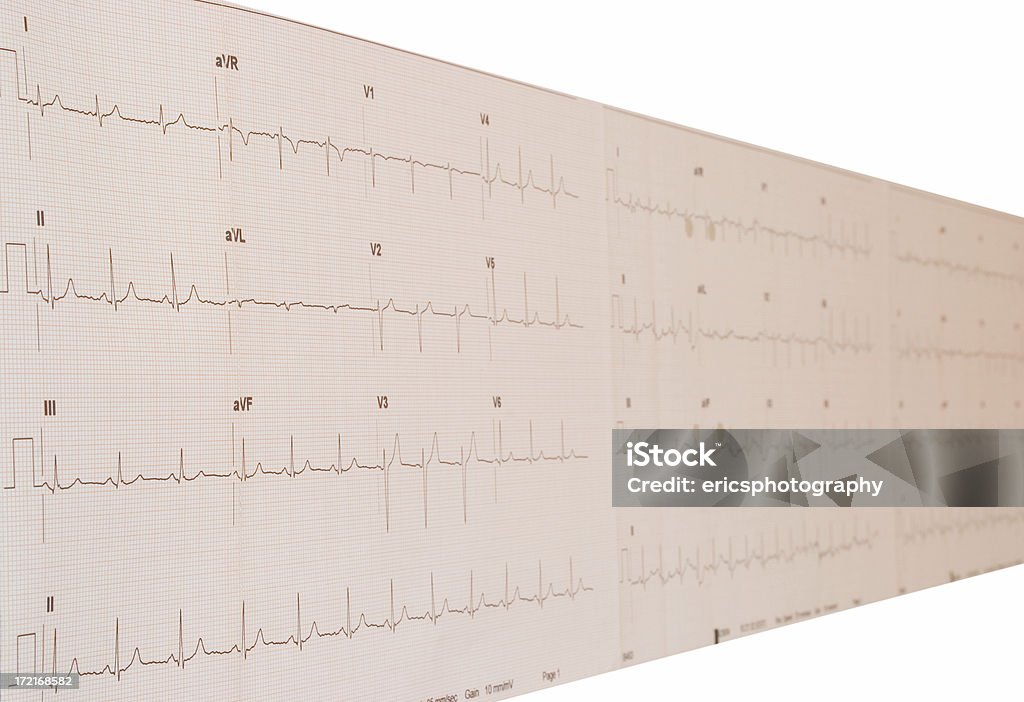 En el electrocardiograma - Foto de stock de Agresión libre de derechos