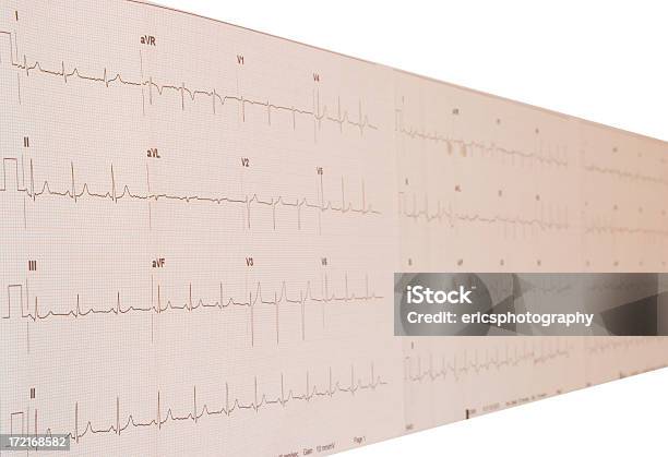 Cardiogram — стоковые фотографии и другие картинки Агрессия - Агрессия, Без людей, Белый фон