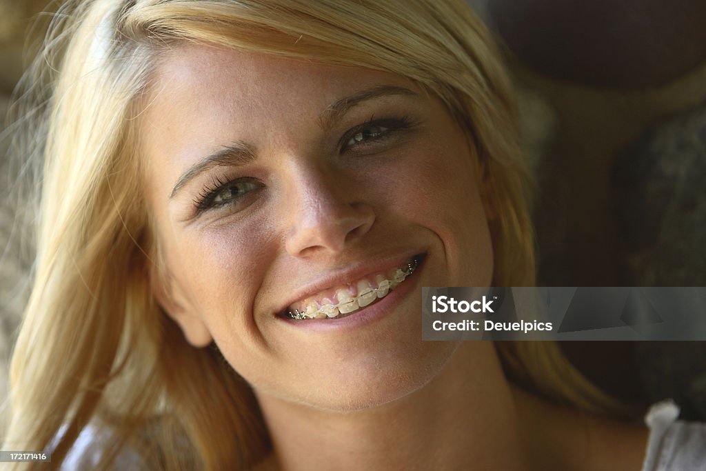 Smiling young women A young women with braces. Dental Braces Stock Photo