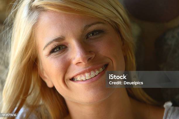 Smiling Young Women Stock Photo - Download Image Now - Dental Braces, Adult, Teenagers Only