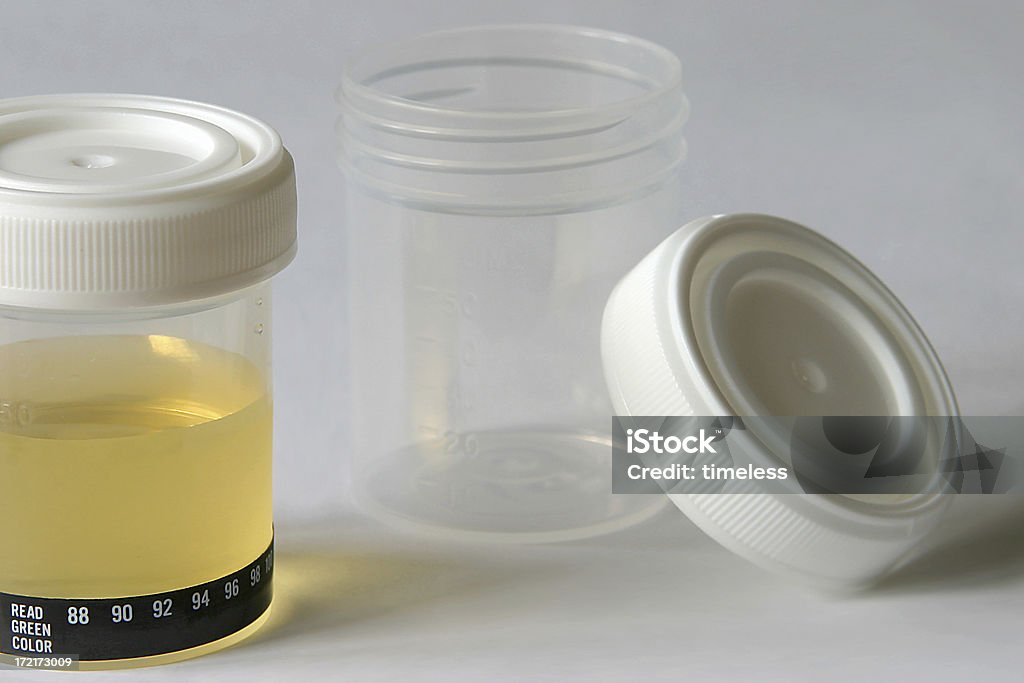 Campione di urine per il test - Foto stock royalty-free di Ambientazione interna