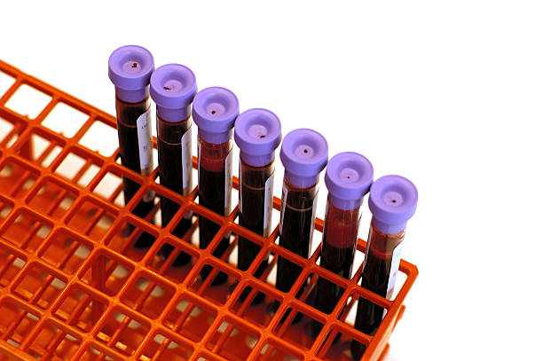 blood tubes in rack stock photo