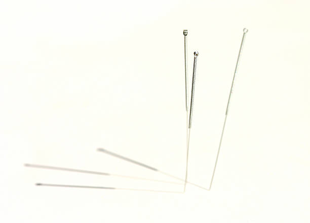 agujas de acupuntura - acupuncture needle fotografías e imágenes de stock