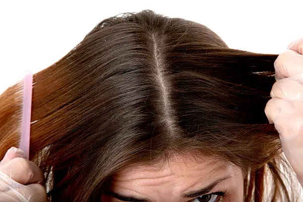 Picture of a woman combing her hair. At 100% you can see the dandruff in the hair.