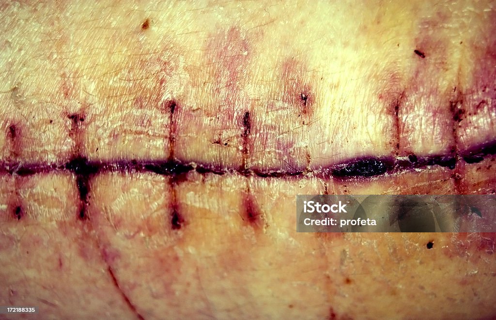 Scary cicatriz - Foto de stock de Gore Range libre de derechos