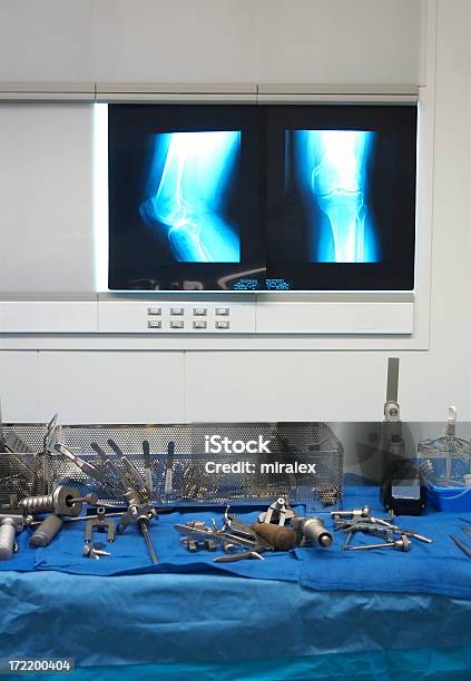 Instrumentos Cirúrgicos Radiografia - Fotografias de stock e mais imagens de Grampo de fixação - Grampo de fixação, Rótula, 2000-2009