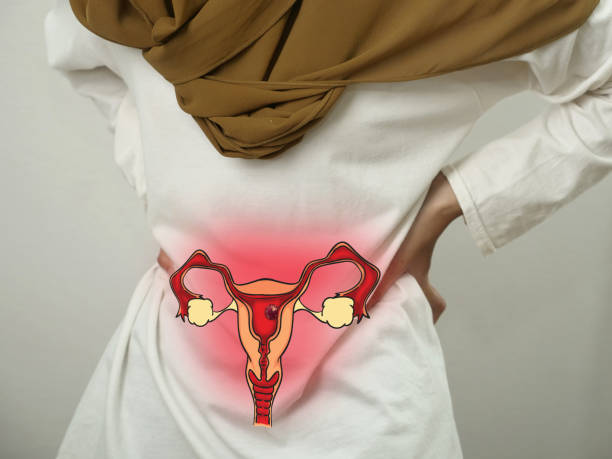 istock Digital composition of women internal reproduction system with highlighted red inflammation on sick person, female person with stomach pain, health and medical 1722008153