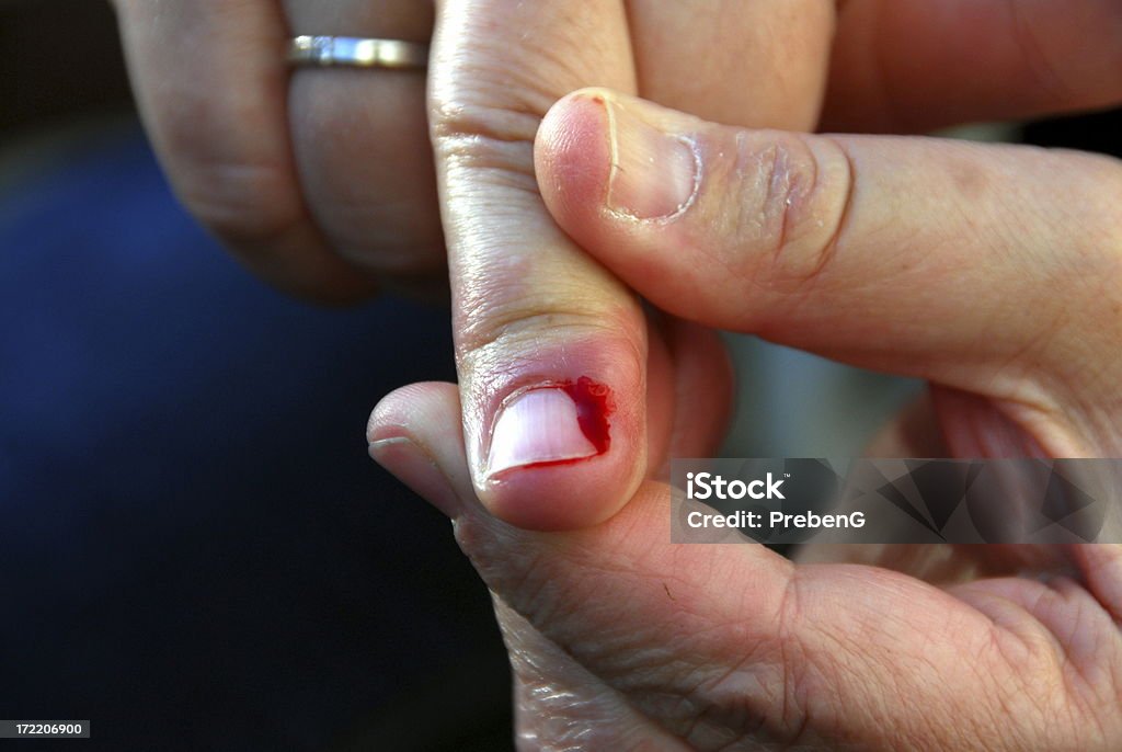 Heridas - Foto de stock de Asistencia sanitaria y medicina libre de derechos