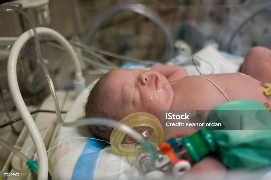 Incubatrice neonato - Foto stock royalty-free di Bebé