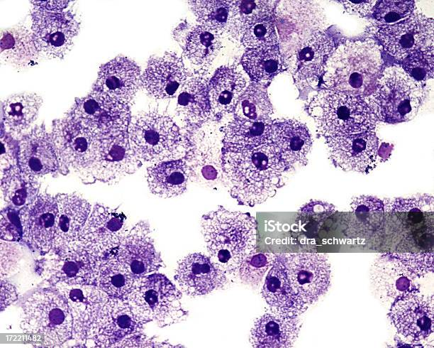 Globuli Di Sangue Bianca E Umana - Fotografie stock e altre immagini di Sistema immunitario - Sistema immunitario, Microscopio, Globulo bianco
